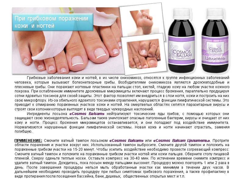 Грибковые заболевания кожи и ногтей, в их числе онихомикоз, относятся к группе инфекционных заболеваний